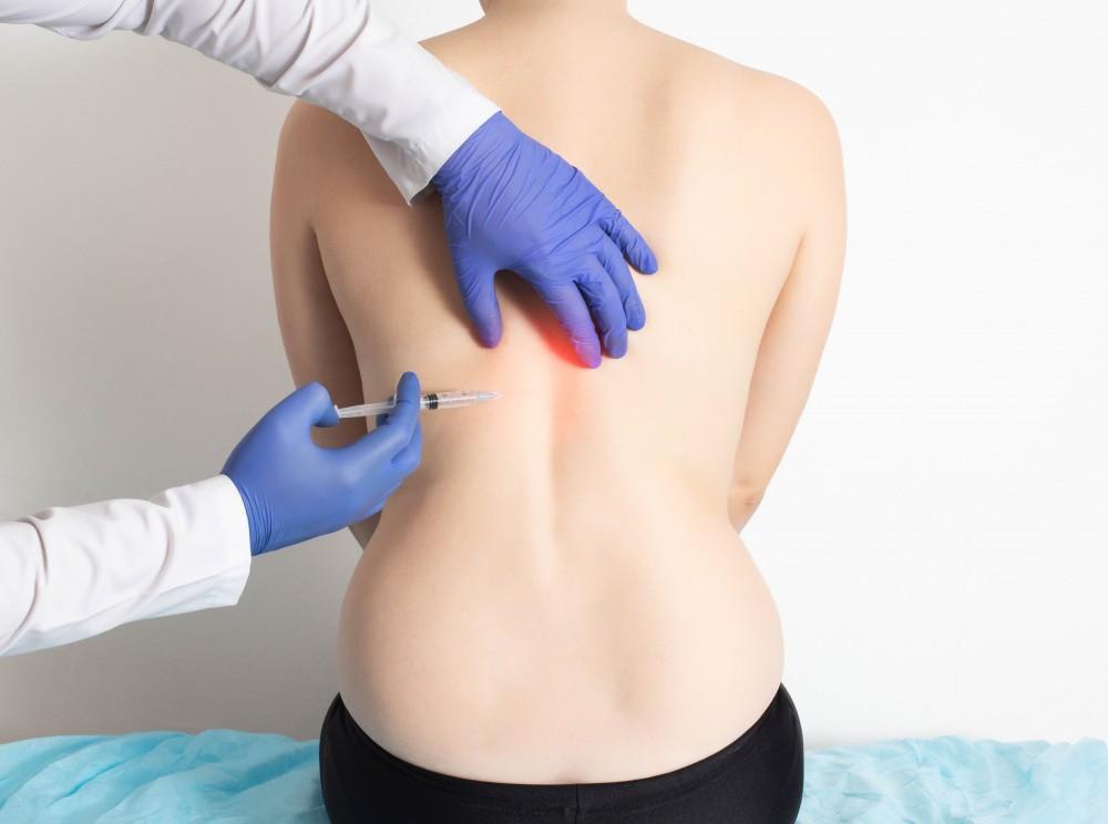 Nerve block injections in Monmouth County 2